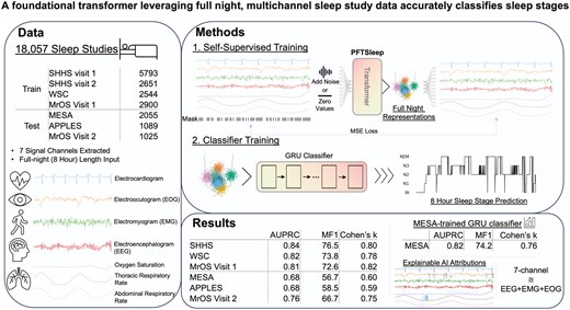 新しいAIモデルが睡眠の全夜分析を高精度で実施(New AI Model Analyzes Full Night of Sleep With High Accuracy in Largest Study of Its Kind) 新しいAIモデルが睡眠の全夜分析を高精度で実施(New AI Model Analyzes Full Night of Sleep With High Accuracy in Largest Study of Its Kind)