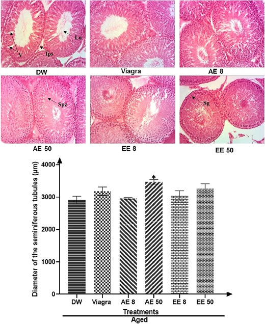 Effects of Corynanthe pachyceras on testis histology (hematoxylin and eosin, X 400) and diameter of seminiferous tubules of aged male rats after two weeks of treatment. Ips, interstitial space. Lu, lumen. Sg, spermatogonia. Spz, spermatozoa. V, vacuolation. N = 6. *, P < .01 compared to DW. DW, untreated distilled water (10 mL/kg). Viagra 5 mg/kg. AE 8 aqueous extract (8 mg/kg). AE 50, aqueous extract (50 mg/kg). EE 8, ethanolic extract (8 mg/kg). EE 50, ethanolic extract (50 mg/kg).