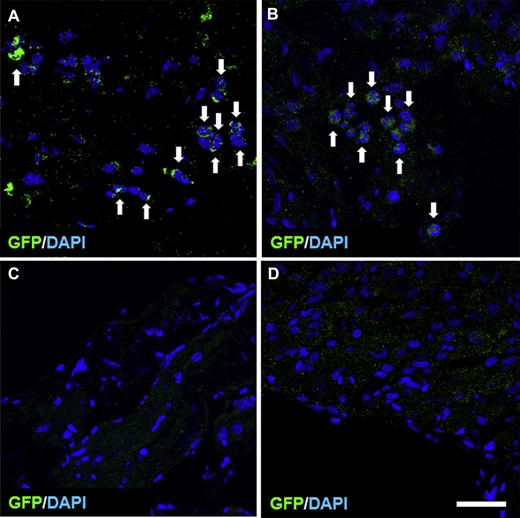 Panels A and B show transverse sections of injured cavernosal nerves and injured major pelvic ganglia, respectively, after intravenous infusion of GFP-MSCs (green; white arrows). Endogenous cells were stained with DAPI (blue). Panels C and D show that after infusion of non–GFP-MSCs from wild-type Sprague-Dawley rats, no GFP+ cells were observed in the cavernosal nerves and major pelvic ganglia, respectively. Scale bar = 150 μm. DAPI = 4',6-diamidino-2-phenylindole; GFP = green fluorescent protein.