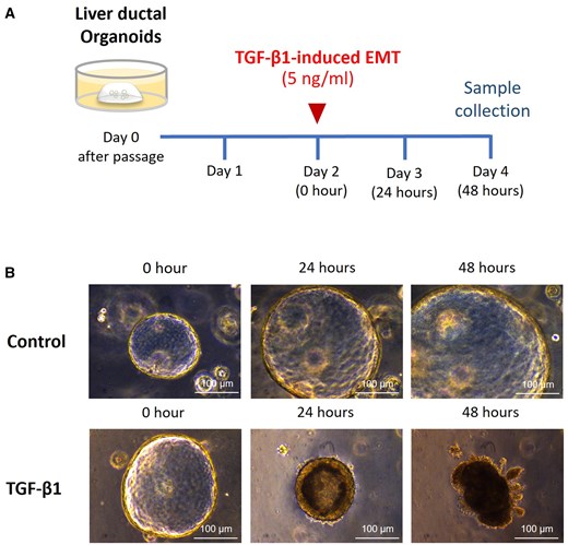 Anti-fibrotic effect of human amniotic fluid stem cells in biliary epithelial-mesenchymal transition of liver ductal organoid Anti-fibrotic effect of human amniotic fluid stem cells in biliary epithelial-mesenchymal transition of liver ductal organoid