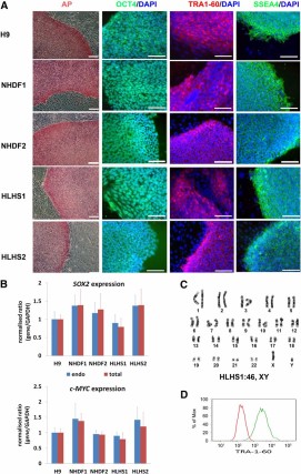 Molecular characterization of human induced pluripotent stem cell (iPSC) lines derived from an HLHS patient and an unaffected control. (A): Staining of NHDF-derived control- and HLHS-iPSC lines and H9 human embryonic stem cells with pluripotency markers and AP. DAPI staining of the nuclei is shown in blue. This is a representative example of at least three independent experiments. Scale bars = 100 μm. (B): Quantitative reverse transcription-polymerase chain reaction analysis for the expression of total and endogenous c-MYC and SOX2 relative to GAPDH with H9 as calibrator (set to 1). Data are presented as mean ± SEM, n = 3. (C): A representative example of karyotypic analysis of HLHS-iPSC1 showing a normal 46 XY karyotype. (D): Flow cytometric analysis for expression of TRA-1-60. The red line represents the cell population stained with the isotype control, and the green line represents the control sample stained with TRA-1-60 antibody. This is a representative example of at least three independent replicates with the NHDF1 iPSC clone. Abbreviations: AP, alkaline phosphatase; DAPI, 4′,6-diamidino-2-phenylindole; GAPDH, glyceraldehyde-3-phosphate dehydrogenase; HLHS, hypoplastic left heart syndrome; NHDF, neonatal human dermal fibroblast.