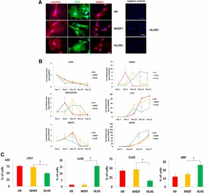Differentiation of NHDF-derived control-induced pluripotent stem cells (iPSCs), HLHS-iPSCs, and H9 human embryonic stem cells (hESCs) to cardiac myocytes (CMs) in vitro. (A): Staining with cardiac markers α-actinin, cTnT, and HAND1. Note a mixed expression pattern of HAND1 in nucleoli and nucleus, as previously described in the literature. 4′,6-Diamidino-2-phenylindole staining of nuclei is shown in blue. Shown is a representative example of at least three independent experiments. Scale bar = 100 μm (left panel) and 47.62 μm (negative controls). (B): Quantitative reverse transcription-polymerase chain reaction analysis showing changes in cardiac marker expression during the differentiation of iPSC and hESC lines. Human embryonic heart cDNA was used as calibrator for MESP1, GATA4, cTnT, and MYH6, and hESC cDNA was used as calibrator for SOX2 and BRACHYURY. The calibrator value was set to the value of 1, and all other data were calculated with respect to that. Data are presented as mean ± SEM, n = 6. ∗, Significant differences (p < .05) in expression between HLHS and each of the controls: H9 and NHDF as revealed by t test at the particular time point of differentiation. (C): Flow cytometric data analysis of cardiac markers demonstrating changes in expression profiles of HLHS-iPSC-derived CMs when compared with control-derived cells at day 21 of differentiation. Data are presented as mean ± SEM, n = 6. Analysis of variance single-factor analysis, followed by Bonferroni post hoc test, indicated significant differences between HLHS and each of the controls (H9 and NHDF) but no differences between NHDF and H9. For simplicity, only p < .05 (∗) is indicated for the comparison between NHDF and HLHS iPSC lines. Abbreviations: ANP, atrial natriuretic peptide; cTnT, cardiac troponin; GAPDH, glyceraldehyde-3-phosphate dehydrogenase; HAND1, heart- and neural crest derivatives-expressed protein 1; HLHS, hypoplastic left heart syndrome; NHDF, neonatal human dermal fibroblast.