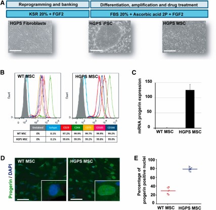 Derivation and characterization of MSCs from HGPS iPSCs. (A): Schematic representation of the pathological modeling strategy and the iPSC differentiation protocol. Scale bars = 50 μm. (B): Flow cytometry analysis of CD29, CD44, CD73, CD105, and CD166 expression in WT MSCs and HGPS MSCs. (C): Quantitative polymerase chain reaction analysis of progerin expression in WT MSCs and HGPS MSCs. Data are normalized on the 18S housekeeping gene. Each chart represents the mean ± SD of three independent experiments. (D): Progerin immunostaining in WT MSCs and HGPS MSCs. Scale bars = 50 μm. (E): Automated quantification of progerin immunopositive nuclei in WT MSCs and HGPS MSCs. The chart represents the dispersion of 12 independent experiments. Abbreviations: DAPI, 4′,6-diamidino-2-phenylindole; FBS, fetal bovine serum; FGF2, fibroblast growth factor 2; HGPS MSC, MSCs derived from Hutchinson-Gilford progeria syndrome iPSCs; iPSC, induced pluripotent stem cell; KSR, knockout serum replacement; MSC, mesodermal stem cells; WT MSC, MSCs derived from control iPSC lines (wild-type).