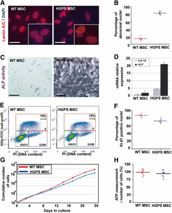 Molecular characterization of HGPS MSCs. (A): Lamin A/C staining (JOL2) in WT MSCs and HGPS MSCs. Scale bars = 25 μm. (B): Automated quantification of abnormal nuclei in WT MSCs and HGPS MSCs. The chart represents the dispersion of eight independent experiments. (C): ALP activity in WT MSCs and HGPS MSCs differentiated in osteoblastic lineage (7 days of differentiation). Scale bars = 50 μm. (D): Quantitative polymerase chain reaction analysis of ALP and collagen type 1A expression in WT MSCs and HGPS MSCs. Data are normalized on the 18S housekeeping gene. Each chart represents the mean ± SD of three independent experiments. (E): Cell cycle analysis after 5-ethynyl-2′-deoxyuridine incorporation in WT MSCs and HGPS MSCs. Values represent the mean ± SD of three independent experiments. (F): Automated quantification of Ki-67 immunopositive nuclei in WT MSCs and HGPS MSCs. The chart represents the dispersion of eight independent experiments. (G): Cumulative number of WT MSCs and HGPS MSCs during 24 days of cultures. (H): Measure of ATP content in WT MSCs and HGPS MSCs. The chart represents the dispersion of eight independent experiments. Abbreviations: ALP, alkaline phosphatase; DAPI, 4′,6-diamidino-2-phenylindole; FBS, fetal bovine serum; HGPS MSC, mesodermal stem cells derived from Hutchinson-Gilford progeria syndrome induced pluripotent stem cells; PI, prodidium iodide; WT MSC, mesodermal stem cells derived from control induced pluripotent stem cell lines (wild-type).