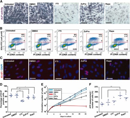 Effect of the different pharmacological treatments on osteogenic differentiation, cellular proliferation, and energy metabolism. (A): Alkaline phosphatase activity in mesodermal stem cells derived from Hutchinson-Gilford progeria syndrome induced pluripotent stem cells (HGPS MSCs) differentiated in osteoblastic lineage (7 days of differentiation) in the presence of the different treatments. Scale bars = 50 μm. (B): Cell cycle analysis after 5-ethynyl-2'-deoxyuridine incorporation in HGPS MSCs in the presence of the different treatments. Values represent the mean ± SD of three independent experiments. (C): Ki-67 immunostaining in HGPS MSCs following 72 hours of treatment. Scale bars = 25 μm. (D): Automated quantification of Ki-67 immunopositive nuclei in HGPS MSCs following 72 hours of treatment in a cumulative dose. Each plot represents the percentage of Ki-67-positive nuclei, and the horizontal bar represents the mean value of each condition. (E): The cumulative number of HGPS MSCs during 24 days of culture in the presence of the different drugs. (F): The measure of ATP content in HGPS MSCs following 72 hours of treatment. Each plot represents the values of ATP content per cell, and the horizontal bar represents the mean value of each condition. Abbreviations: DAPI, 4′,6-diamidino-2-phenylindole; DMSO, dimethyl sulfoxide; FTI, farnesyltransferase inhibitor; PI, prodidium iodide; Rapa, rapamycin; ZoPra, zoledronate and pravastatin.