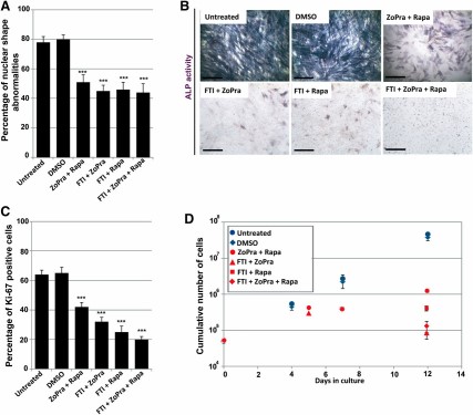 Molecular characterization of FTI, ZoPra, and Rapa drug combinations on mesodermal stem cells derived from Hutchinson-Gilford progeria syndrome induced pluripotent stem cells (HGPS MSCs). (A): Quantification of misshapen nuclei in HGPS MSCs following 72 hours of treatment with the different drug combinations. Values represent the mean ± SD of three independent experiments. (B): Alkaline phosphatase activity in HGPS MSCs differentiated in osteoblastic lineage (7 days of differentiation) in the presence of the different drug combinations. Scale bars = 50 μm. (C): Automated quantification of Ki-67 immunopositive nuclei in HGPS MSCs following 72 hours of treatment with the different drug combinations. Values represent the mean ± SD of three independent experiments. (D): The cumulative number of HGPS MSCs during 12 days of culture in the presence of the different drug combinations. Abbreviations: DAPI, 4′,6-diamidino-2-phenylindole; DMSO, dimethyl sulfoxide; FTI, farnesyltransferase inhibitor; Rapa, rapamycin; ZoPra, zoledronate and pravastatin.