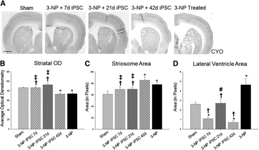 Cytochrome oxidase labeling. (A): Analysis of the brain scans labeled with CYO revealed significant between-group differences in optical densitometry measures in the striatum (B). It was also revealed that rats receiving iPSC transplantation at 7 or 21 days had significantly higher optical densitometry measures in the striatum than 3-NP rats that did not receive transplants or 3-NP rats that received iPSC transplantation at 42 days. In addition, analysis of the striosome area revealed significant between-group differences (C). Rats receiving iPSC transplantation at 7 or 21 days had significantly smaller striosome area when compared with 3-NP rats that did not receive transplants or 3-NP rats that received iPSC transplantation at 42 days. Scans from the same sections also revealed significant between-group differences in the area of the lateral ventricles (D). All groups receiving iPSC transplantation had significantly smaller lateral ventricles when compared with 3-NP rats that did not receive transplants. (Bar graph represents mean value; error bars represent SEM; ∗, significantly different from sham rats, p < .05; †, significantly different from 3-NP rats without transplants, p < .05; #, significantly different from 3-NP iPSC 7-day rats, p < .05; ‡, significantly different from 3-NP iPSC 42-day rats, p < .05.) Abbreviations: 3-NP, 3-nitropropionic acid; iPSC, induced pluripotent stem cell; OD, optical density.