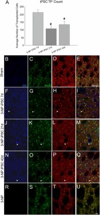 Immunohistochemical analysis of transplanted iPSCs (blue), mature neurons (NeuN; green), and medium spiny neurons (Darpp32; red). All transplanted rats displayed surviving iPSCs (blue) around the injection site at the conclusion of the study. However, a significant between-group effect was observed for the average number of surviving iPSCs (A). It was revealed that the 7-day transplantation time point had significantly more surviving iPSCs than the 21- or 42-day transplantation group. Sham rats are shown in (B–E); 7-day iPSC rats are shown in (F–I); 21-day iPSC rats are shown in (J–M); 42-day rats are shown in (N–Q); 3-NP rats that did not receive transplants are shown in (R–U). (Scale bar = 50 μm; colocalization is shown by white arrowheads; bar graph represents mean value; error bars represent SEM; #, significantly different from 3-NP iPSC 7-day rats, p < .05.) Abbreviations: 3-NP, 3-nitropropionic acid; iPSC, induced pluripotent stem cell.