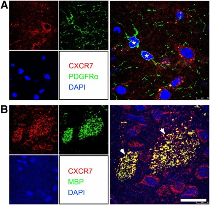 CXCR7 was not detected on OPCs but on mature myelin sheaths in the 5-week postischemic mouse brain. Double immunostaining confocal images showed CXCR7 (red) was barely detected on PDGFRα+ cells (green, asterisks) (A) but coexpressed with MBP+ mature myelin sheath (green, arrows) (B). Scale bar = 20 μm. Abbreviations: CXCR, C-X-C receptor; DAPI, 4′,6-diamidino-2-phenylindole; MBP, myelin basic protein; OPCs, oligodendrocyte progenitor cells; PDGFRα, platelet-derived growth factor receptor-α.
