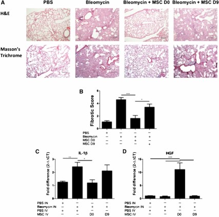 Early administration of MSCs protects lungs from bleomycin-induced fibrosis. Lungs were harvested on D28 of the bleomycin model for histological assessment. (A): Representative images of H&E (upper panel) and trichrome-stained (lower panel) lung sections (10×) show collagen deposition and alveolar damage. Scale bar = 200 μm. (B): Fibrotic score was significantly reduced when MSCs were administered on D0 but not on D9. (C): mRNA expression of IL-1β was measured in the lungs using qPCR on D21 of the bleomycin study. IL-1β mRNA expression was reduced when MSCs were administered on D0 but not day D9. (D): HGF mRNA expression was measured in the lungs using quantitative polymerase chain reaction. HGF mRNA expression was enhanced when MSCs were administered on D0 but not on D9. n = 5. ∗, p < .05; ∗∗, p < .01; ∗∗∗, p < .001. Abbreviations: D, day; H&E, hematoxylin and eosin; HGF, hepatocyte growth factor; IL-1β, interleukin-1β; IN, intranasal; IV, intravenous; MSC, mesenchymal stromal cell; PBS, phosphate-buffered saline.