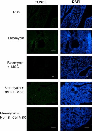 MSC-mediated protection of lungs from bleomycin through reduction of apoptosis in an HGF-dependent manner. TUNEL analysis was carried out on lung sections to demonstrate that bleomycin induced apoptosis in the lungs, although MSC treatment reduced this. However, this antiapoptotic effect was lost when mice were treated with HGF KD MSCs, demonstrating that MSCs require HGF to protect against apoptosis. Tissue was counter-stained with DAPI. Representative images from n = 5 mice per group. Scale bars = 50 μm. Abbreviations: DAPI, 4′,6-diamidino-2-phenylindole; HGF, hepatocyte growth factor; MSC, mesenchymal stromal cell; Non Sil Ctrl, nonsilencing control; PBS, phosphate-buffered saline; shHGF MSC, shRNA HGF knockdown MSC; TUNEL, terminal deoxynucleotidyl transferase dUTP nick-end labeling.
