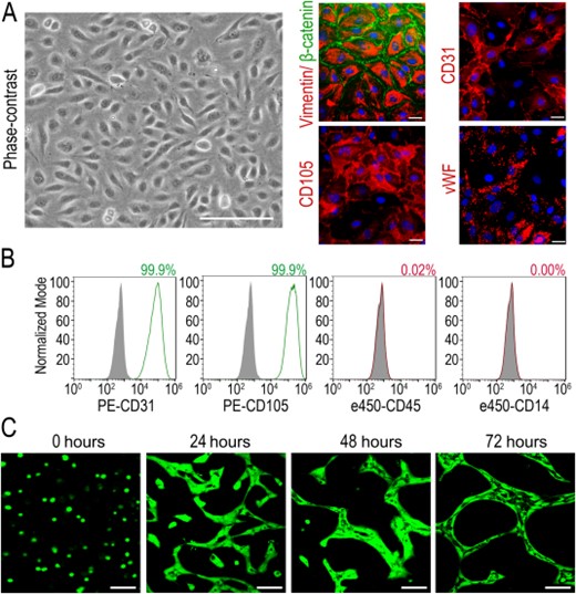 Phenotypical characterization of endothelial colony-forming cells (ECFCs). (A): Representative phase-contrast image of ECFCs. Scale bar = 200 µm, and immunocytochemistry for von Willebrand factor, CD31, CD105, vimentin, and β-catenin. Scale bars = 25 µm. (B): Cell surface immunophenotyping of ECFCs by flow cytometry. Filled gray histograms show respective isotype controls and colored histograms show expression of endothelial markers (CD31, CD105, shown in green) and hematopoietic markers (CD45, CD14, shown in red). Percentage of positive cells for each marker is shown in the top right of each panel. (C): In vitro three-dimensional Matrigel tubulogenesis assay showing tube-like structures with lumens formed by ECFCs stained in green with Calcein. Scale bars = 100 µm.
