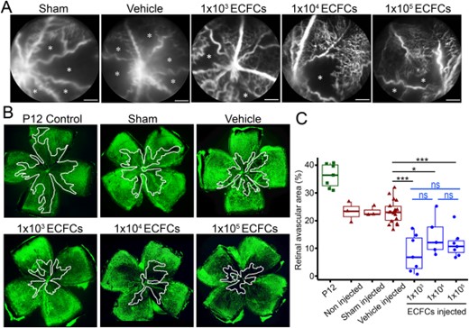 Intravitreal delivery of low dose ECFCs demonstrates therapeutic efficacy comparable to higher cell doses in the murine oxygen induced retinopathy model. (A): Representative fluorescein angiographs acquired in post-natal day 17 (P17) mice demonstrating the retinal vasculature in vivo. Avascular areas are highlighted with an asterisk. Scale bars = 1 mm. (B): Representative flat-mounted retinas (magnification ×4) from P17 mice stained with isolectin B4 (Alexa488) to identify the retinal vasculature. Avascular areas are delineated in white. (C): Quantification of avascular area expressed as a percentage of total retina area. Figure shows individual data points with mean, interquartiles, and range. *, p < .05; ***, p < .001, ns: not significant. One-way ANOVA with Bonferroni's post-test. Figure shows statistical significance compared to vehicle treated retinas. Abbreviations: ECFCs, endothelial colony-forming cells; P12, post-natal day 12.