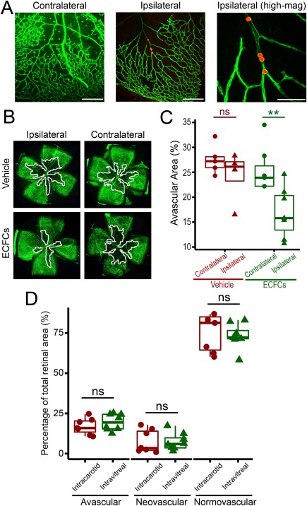 Systemic administration, via the common carotid artery, can be successfully used as an alternative route of delivery for ECFC-cell based therapy. (A): High magnification photomicrographs of isolectin B4 (Alexa488) stained mouse retina flatmounts following intracarotid injection of orange-red fluorescent microspheres. Left image shows retinal vasculature of the contralateral right eye on P13, where there is no evidence of microspheres 2 hours following systemic administration via the left common carotid artery (scale bar = 300 µm). Middle image shows microspheres in retinal vasculature of the ipsilateral left eye on P13, 2 hours after injection (scale bar = 300 µm). Image on right shows microspheres at higher magnification (scale bar = 100 µm). (B): Representative photomicrographs of isolectin B4 (Alexa488) stained retina flatmounts of both ipsilateral and contralateral eyes from P17 oxygen induced retinopathy mice following injection of either vehicle or 1 × 105 ECFCs into the left common carotid artery (magnification ×4). Avascular areas are outlined in white. (C): Quantification of avascular areas on retina flatmounts of vehicle and ECFC treated mice. Data presented as individual data points with mean, interquartiles, and range. **, p < .01, One-way ANOVA with Bonferroni's post-test. Figure shows statistical significance in ipsilateral left eyes compared to contralateral right eyes in ECFC treated mice. (D): Quantitative comparison of the therapeutic efficacy of intracarotid and intravitreal ECFC delivery routes. Ipsilateral retinas (left eye) from intracarotid ECFC treated mice were compared to retinas where ECFCs were delivered directly into the vitreous at the same cell dose (1 × 105 ECFCs). All retinas were examined at P17. Data presented as individual data points with mean, interquartiles, and range. Two sample t tests for intracarotid versus intravitreal, p > .05, ns: not significant. Abbreviations: ECFC, endothelial colony-forming cell; P, postnatal day.