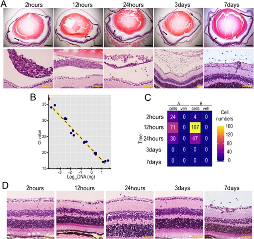Endothelial colony forming cells (ECFCs) do not induce adverse effects in healthy, adult mouse eyes following intravitreal delivery. (A): Top panel shows representative H&E stained whole eye sections (×4) acquired 2 hours, 12 hours, 24 hours, 3 days, or 7 days following intravitreal injection of 1 × 105 ECFCs. Black scale bars: 500 µm. Black arrows denote the areas shown at higher magnification (×40) in the lower panel, where hematoxylin stained ECFCs are visible in the vitreous. Yellow scale bars: 50 µm. (B): Standard curve for Alu-polymerase chain reaction (Alu-PCR) analysis correlating amount of human DNA with PCR Ct value. Blue points are human DNA samples and red triangles are water samples. (C): Alu-PCR for human ECFC tracking was used to detect human DNA in cell and vehicle injected retinas in two mice. The quantitative data are displayed in a heatmap with corresponding cell number indicated inside the tiles. (D): Mouse retinal tissue cross sections at different time points after cell delivery stained with H&E to assess for retinal integrity (×40 magnification). Yellow scale bars: 50 µm.