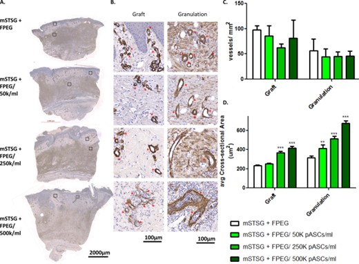 Quantitative comparison of blood vessels within both graft and granulation tissue. (A): Representative pictures of biopsies from day 10 post-burn stained with alpha smooth muscle actin (α-SMA) from wounds treated with mSTSG and increasing amounts of pASCs. (B): High magnification images of both retained autograft and granulation tissue reveals differences in blood vessels (asterisks), as well as qualitative differences seen in the myofibroblasts (diffuse staining). Quantification of both the average number of blood vessels per mm2 (C), and average size of blood vessels (D) present within graft and granulation tissue is shown. Two-way ANOVA reveals a dose-dependent effect of pASCs on the size of blood vessels- **, p < .01; ***, p < .001 (compared with FPEG alone). (Scale bars are 2,000 and 100 µm). Abbreviations: FPEG, PEGylated fibrin; mSTSG; meshed split thickness skin grafts.