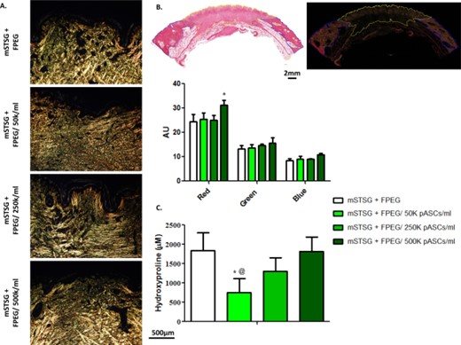 The effect of pASCs on collagen deposition. (A): Representative pictures of biopsies stained with picrosirius red and taken under polarized light. An apparent decrease in organized collagen bundles is seen when a low amount of pASCs (50K cells per ml) are added to wounds, which recovers in a dose-dependent fashion. (B): Example tracings of the entire day 42 biopsy under brightfield and polarized light which was used to quantify the mean intensity in red, green, and blue channels. Two-way ANOVA reveals that 500K pASCs/ml led to more red intensity than without cells, measured in AU. (C): Quantification of total collagen in wound beds from day 42 post-burn shows an initial decrease, and then recovery of collagen content with increasing amounts of cells. (Scale bars are 500 µm and 2 mm). Abbreviations: AU, arbitrary units; FPEG, PEGylated fibrin; mSTSG; meshed split thickness skin grafts; pASC, porcine adipose-derived stem cell.