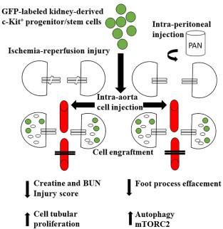 c-Kit+ progenitor/stem cells contribute to kidney regeneration following acute injury. c-Kit+ progenitor/stem cells can regenerate epithelial tubular cells following ischemia-reperfusion injury and accelerate foot processes effacement reversal in a model of acute proteinuria in rats. These cells engraft and differentiate into renal structures, such as tubules, vessels, and podocyte-like cells. Paracrine mechanisms could also account for kidney regeneration, either by stimulating proliferation of surviving cells or modulating autophagy and podocyte cytoskeleton rearrangement through mTOR-Raptor and- Rictor signaling, which ultimately lead to morphological and functional improvement. Abbreviations: BUN, blood urea nitrogen; mTORC2, mammalian target of rapamycin complex 2; PAN, puromycin aminonucleoside.