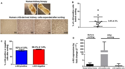 c-Kit cells are found in human kidneys. (A): A human kidney biopsy was obtained from a male deceased donor, 36-year, with brain trauma. c-Kit cells were sorted out by flow cytometry and successfully expanded for several days (D). (B): c-Kit cells were found to be positive in 3.6% ± 3% of the kidney cells before sorting in human kidney biopsies obtained from deceased donors (n = 12 analyses in eight human kidney donors). (C): The positive fraction for c-Kit cells that were sorted out exhibited 92% ± 5.8% positivity for c-Kit while the negative fraction exhibited negativity for c-Kit in 98.3% ± 1.6% of the cells. (D) By qPCR, positivity for c-Kit was also higher in the c-Kit positive fraction. Scale bars represent 20 μm for (A) images.