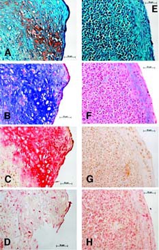 Chondrogenic induction. (A–D): Equine bone marrow-derived mesenchymal stem cell (MSCs). (E–H): Equine peripheral blood-derived progenitors (ePBPs). Histological staining included safranin O (A, E) and alcian blue (B, F). Immunohistochemistry used antibodies specific for collagen type II (C, G) and collagen type I (D, H). After 2 weeks of chondrogenic induction, equine MSCs showed a clear development of cartilage specific stainings, whereas ePBPs did not. Magnifications ×40.