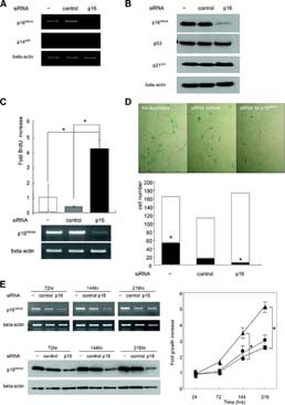 Knockdown of p16INK4A prevented senescence and restored proliferation. (A): Inhibition of p16INK4A gene expression by p16-siRNA. siRNA for a scramble sequence (control-siRNA) was used as a control. (B): Specific inhibition of p16 protein expression by p16-siRNA. (C): Incorporation of BrdU after siRNA treatment. Effective inhibition of p16INK4A expression by p16-siRNA was confirmed by reverse transcription-polymerase chain reaction shown in the lower part of the figure; *, p < .01. (D): Senescence associated-β-galactosidase (SA-β-Gal) staining after siRNA treatment. Representative data were shown in the upper part of the figure, and SA-β-Gal-positive (black square) and negative (white square) cells were counted as described in the Materials and Methods section and are shown in the lower part; *, p < .01. Note that total cell number was decreased in the control-siRNA-treated cells, whereas the number in the p16-siRNA-treated cells was equal to that in untreated cells. (E): Growth profile of human MSCs after siRNA treatment. Living cells of each group (▴, treated with p16-siRNA; •, treated with control-siRNA; ▪, no treatment) were numerated at each time point, and the fold increase compared with the number at 24 hours after siRNA treatment was demonstrated; *, p < .01. Abbreviations: BrdU, 5-bromo-2′-deoxyuridine; hr(s), hours; siRNA, small interfering RNA.