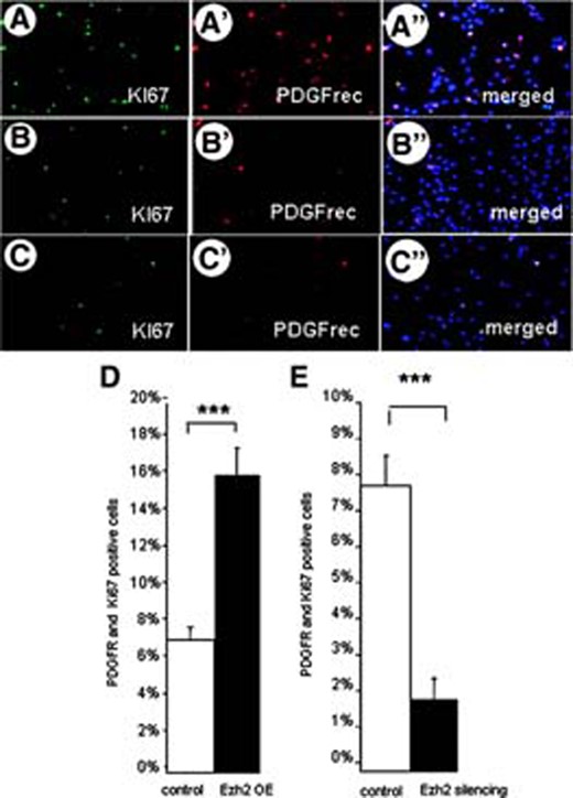 Oligodendrocyte precursor cell (OPC) proliferation and Ezh2 expression. The number of proliferating OPCs is determined by using double immunostaining for KI67 and PDGFrec α after inducing Ezh2 overexpression (A–A″) in control conditions (B–B″) and after Ezh2 silencing (C–C″). Quantification in (D) showed that overexpression of Ezh2 in freshly differentiated OPCs stimulates their proliferation, whereas silencing of Ezh2 expression (E) results in a decrease of proliferating OPCs (means of three independent experiments ± SE; ***, p < .001, Student's t test). Abbreviations: Ezh2, enhancer of zeste homolog 2; OE, overexpression; PDGF, platelet-derived growth factor; PDGFR, PDGF receptor.