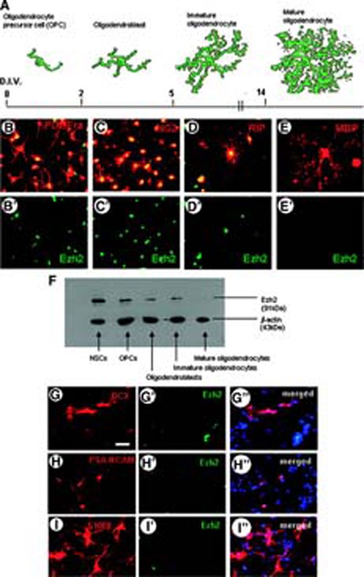 Expression of Ezh2 during various stages of in vitro differentiation of mouse embryonic NSCs. (A): Schematic drawings of the stages of oligodendrocyte differentiation (appearing after indicated days in vitro) that are shown in (B–E), immunostained (red fluorescent) for PDGFR-α, NG2, RIP, and MBP, respectively. Double staining of these stages for Ezh2 (green fluorescent, singular Ezh2 staining in B′–E′) shows that Ezh2 is expressed during all stages of oligodendrocyte differentiation but not in the mature oligodendrocytes. (F): Western blot analysis of Ezh2 expression in the various oligodendrocyte stages confirms the immunohistochemical findings. (G–I): Double immunostaining for Ezh2 and DCX (G–G″), PSA-NCAM (H–H″) and S100β (I) shows that, respectively, early neuroblasts (G–H) and freshly formed astroblasts (I–I″) do not express Ezh2 (Hoechst staining is indicated by blue). Scale bar in G for G–I″ = 50 μm. Abbreviations: DCX, doublecortin; D.I.V., days in vitro; Ezh2, enhancer of zeste homolog 2; MBP, myelin basic protein; NSC, neural stem cell; OPC, oligodendrocyte precursor cell; PDGFRa, platelet-derived growth factor receptor-α; PSA, polysialic acid.