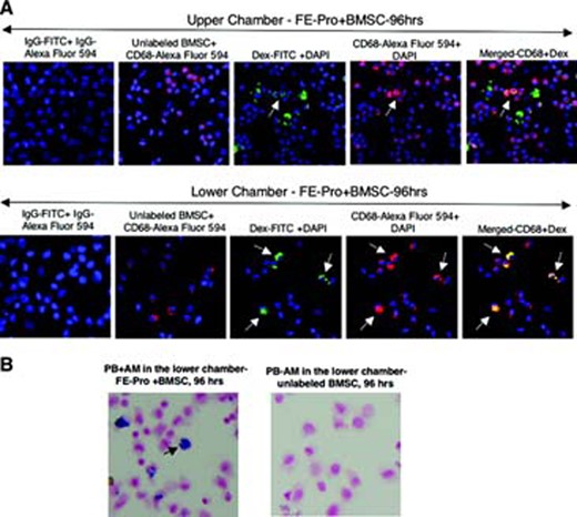Immunofluorescent and PB staining of AM with transferred FE-Pro from live, FE-Pro-labeled human BMSCs. (A): Representative immunofluorescent images showing detection of Dex with anti-Dex-FITC, CD68 with anti-CD68-Alexa Fluor 594 on AM recovered from both chambers; magnification, ×40. On the merged image of the upper chamber, note cells positive for Dex-FITC only (FE-Pro-labeled BMSCs), cells positive for CD68-Alexa Fluor 594 only that are AM, and cells positive for Dex-FITC and CD68-Alexa Fluor 594. Those cells that took up FE-Pro from FE-Pro-labeled BMSCs are AM. On the merged image of the lower chamber, note cells positive for CD68-Alexa Fluor 594 only that are AM and cells positive for Dex-FITC and CD68-Alexa Fluor 594 (AM that took up FE-Pro from FE-Pro-labeled BMSCs). (B): PB staining of AM recovered from the lower chamber after 96 hrs of incubation with FE-Pro labeled and unlabeled BMSCs. Abbreviations: AM, activated macrophages; BMSC, bone marrow stromal cell; DAPI, 4,6-diamidino-2-phenylindole; Dex, dextran; FE-Pro, ferumoxide-protamine sulfate complex; FITC, fluorescein isothiocyanate; hrs, hours; PB, Prussian Blue.