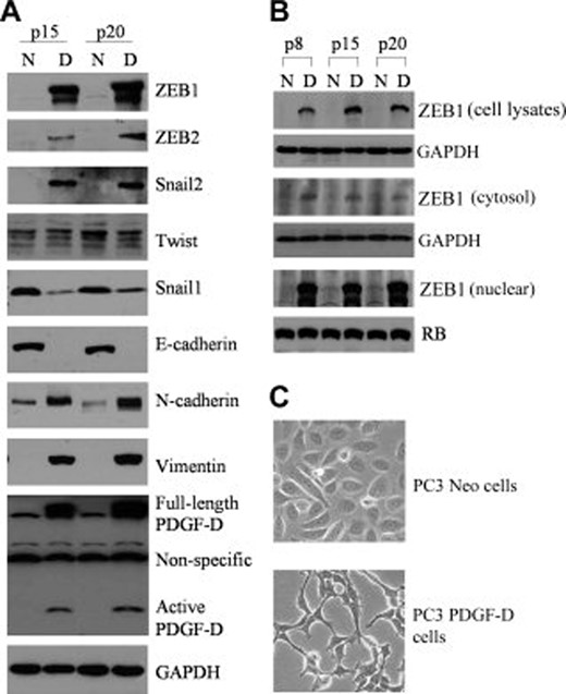 PDGF-D的过度表达在PC3细胞中诱导EMT。（A） ：Western blot分析显示第15代和第20代PC3-Neo和PC3-PDGF-D细胞中PDGF-D、转录抑制因子和其他间充质及上皮标记物的表达。以GAPDH蛋白作为蛋白质负荷控制。（B） ：从PC3 Neo和PC3 PDGF-D细胞第8、15和20代制备总细胞裂解物、胞浆和核提取物。Western blot结果显示ZEB1表达，主要定位于细胞核。GAPDH用于细胞裂解物和胞质提取物的蛋白质负载控制，而RB蛋白质用于核提取物的蛋白质负载控制。（C） ：细胞的显微照片。PC3 Neo细胞呈圆形上皮细胞形状（上表），PC3 PDGF-D细胞呈成纤维细胞型表型（下表）。原始放大倍数，200×。缩写：D，PC3 PDGF-D细胞；EMT，上皮-间质转化；GAPDH，甘油醛-3-磷酸脱氢酶；N、 PC3 Neo细胞；血小板衍生生长因子；p8，第8代；视网膜母细胞瘤；ZEB，锌指电子盒绑定同源盒。