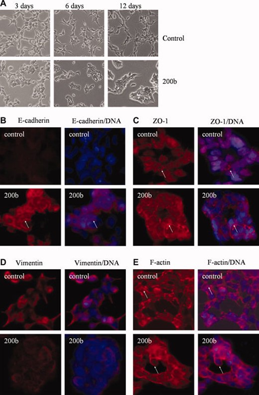 miR-200b逆转PC3 PDGF-D细胞的EMT表型。（A） ：细胞照片。转染阴性对照miRNA的PC3 PDGF-D细胞表现为成纤维细胞型表型（上图）；转染miR-200b的PC3 PDGF-D细胞呈圆形上皮细胞形态，细胞形成簇状（下表）。原始放大倍数，200×。转染21天后，用阴性对照miRNA或miR-200b转染的PC3 PDGF-D细胞进行免疫染色，以检测E-cadherin（B）、ZO-1（C）或vimentin（D）的表达，或用Alexa Fluor 594 phalloidin染色以检测F-actin（E），用DAPI染色以检测DNA以显示细胞核，如方法所述。箭头指示上皮和间充质标记的表达或位置的变化。原始放大倍数，200×。缩写：DAPI，4′，6-二氨基-2-苯基吲哚；EMT，上皮-间质转化；血小板衍生生长因子；ZO，闭塞小带。