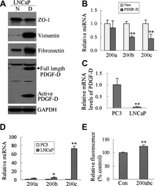 PDGF-D在LNCaP细胞中的过表达诱导EMT特征。（A） ：Western blot分析显示与LNCaP-Neo细胞相比，LNCaP PDGF-D细胞（PDGF-D-过表达细胞）中ZO-1、波形蛋白和纤维连接蛋白的表达水平以及PDGF-D的水平。用GAPDH作为蛋白质负荷控制。N、 LNCaP-Neo细胞；D、 LNCaP PDGF-D细胞。（B） ：使用miRNA-specific Taqman MGB探针和引物测定LNCaP PDGF-D细胞（PDGF-D）和LNCaP-Neo细胞（Neo）中miR-200a、miR-200b和miR-200c的水平。miRNA的相对量归一化为RNU6B。（C） ：实时RT-PCR用于测定PC3和LNCaP细胞中PDGF-D的mRNA水平。相对mRNA水平根据GAPDH标准化。（D） ：使用miRNA特异性Taqman MGB探针和引物测定来自PC3和LNCaP细胞的miR-200a、miR-200b和miR-200c的水平。miRNA的相对量归一化为RNU6B。（E） ：为了进行侵袭试验，将转染了抗miR-200a、抗-miR-200b和抗miR-200 c（抑制剂）或抗-miRNA对照的LNCaP细胞接种到涂有生长因子诱导的Matrigel的Transwell插入物中。培养24小时后，用4μg/ml Calcein AM在37°C磷酸盐缓冲盐水中染色1小时。在485 nm/530 nm的激发/发射波长下，用ULTRA多功能微孔板阅读器读取插入物底部细胞的荧光。显示了相对荧光值。值表示侵入细胞的比较值。Con，抗miRNA控制；200abc、anti-miR-200a、anti-miR-200b和anti-miR-200c（miRNA抑制剂）*p<0.05**与对照组相比，p<0.01。缩写：EMT，上皮-间充质转化；GAPDH，甘油醛-3-磷酸脱氢酶；miRNA，microRNA；血小板衍生生长因子；逆转录聚合酶链反应；ZO，闭塞小带。