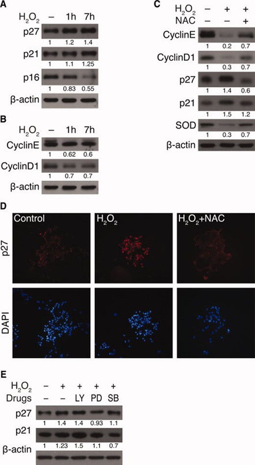 H2O2 augments expression of the cyclin-dependent kinase inhibitors p21Cip1 and p27Kip1 in Atm+/+ neural stem cells. (A and B): Neurospheres were treated with 50 μM H2O2 for indicated times, and the following were measured by Western blotting analysis: (A) levels of p27kip1, p21cip1, and p16Ink4a and (B) levels of cyclin E and cyclin D1. (C): Neurospheres were treated with 50 μM H2O2, either in the absence or presence of NAC, and levels of cyclin E, cyclin D1, p27kip1, p21cip1, and SOD1 were measured. (D): Immunocytochemistry of p27kip1 after treatment of 50 μM H2O2 for 7 hours, either in the absence or presence of NAC. (E): Neurospheres were either left untreated or treated with 50 μM H2O2 in the presence of LY294002, PD98059, or SB203580. Levels of p27kip1 and p21cip1 were measured by Western blotting analysis. Abbreviations: LY, LY294002; NAC, N-acetyl-L-cysteine; PD, PD98059; SB, SB203580; SOD, superoxide dismutase.
