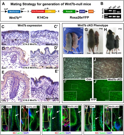 Generation of Wnt7b-null (Wnt7b cKO) transgenic mice with aberrant hair coat production and diminished hair differentiation marker expression. (A): Schematic representation of the mating strategy used to generate Wnt7b-deficient transgenic mice. Wnt7bfl/fl transgenic mice were crossed with K14Cre mice and Rosa26-STOP-eYFP reporter mice to generate offspring with Cre-mediated deletion of Wnt7b in K14+ YFP-labeled epithelial tissue. (B): PCR genotyping was used to distinguish YFP+ control (Con) and YFP+ Wnt7b-deficient mice (Wnt7b cKO). (C–E): Immunohistochemistry (IHC) directed against endogenous Wnt7b protein was performed on Con and (C′, D′, E′) Wnt7b cKO dorsal back skin at E14.5, E16.5, and E18.5 to demonstrate efficient deletion of Wnt7b in Wnt7b cKO transgenic mouse skin. All IHC images were counterstained with hematoxylin (blue) to label nuclei. (F–H): Phenotype of Con and Wnt7b cKO transgenic mice at postnatal day (P) P5 (F), P10 (G), and P18 (H). (I, I′): Dorsal skin of P7 YFP+ Con mice displayed organized, visible hair shafts (HS) protruding from the skin surface. (J, J′): Dorsal skin of P7 YFP+ Wnt7b cKO transgenic mice displayed disorganized, aberrant, and fewer hair shafts at the skin surface. Immunofluorescence directed against known hair follicle differentiation markers K5 (red, K–M′), ae13 (green, K, K′), ae15 (green; L, L′), and Gata3 (green, M, M′) in Con (K, L, M) and Wnt7b cKO transgenic (K′, L′, M′) hair follicles. DAPI (blue) counterstaining was used to label cell nuclei (K–M′). Asterisk labels subcutaneous muscle stained positive (brown) for Wnt7b. Scale bar C–E′, K–M′ = 50μm; I-J′ = 1mm. Abbreviations: DAPI, 4′6-diamidino-2-phenylindole; YFP, yellow fluorescent protein.