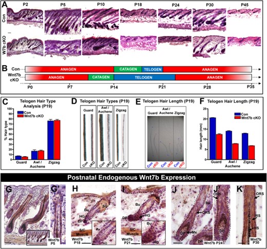 Wnt7b-deficient transgenic mice display aberrant hair follicle cycling. (A): Postnatal HF cycle in Con and Wnt7b cKO transgenic mice (P5–45). (B): Schematic illustrating perturbed HF cycle in Wnt7b cKO mice compared with Con littermates. (C–F): Analysis of plucked, telogen (P19) hairs from Con and Wnt7b cKO mice. (C): Comparison of different HF types of Wnt7b cKO and Con mice. (D): Comparison of the hair shaft structure of Wnt7b cKO and Con mice. (E, F): Length of different hair types from Wnt7b cKO and Con HFs. (G, G′): Wnt7b expression in the ORS cells of P5 anagen HFs (H, I and insets). Changes in Wnt7b expression during telogen to anagen transition between P18 and P21, strong cytoplasmic Wnt7b expression in the enlarged, activated HG, and lower hfSCs (Bu) at anagen onset P21 compared to P18. (J, J′ magnification) At P24, during the first postnatal anagen, Wnt7b is expressed in the ORS, matrix progenitor cells, and (K) in the differentiating layers at P30. All IHC images were counterstained with hematoxylin (blue) to label nuclei. Insets depict magnified regions within the figure. Scale bar = 50 µm. Abbreviations: Bu, bulge; DP, dermal papillae; HFs; hair follicle; HG, hair germ; hfSCs, hair follicle stem cells; HS, hair shaft; IRS, inner root sheath; ORS, outer root sheath; P, postnatal day; S/C, subcutaneous; SG, sebaceous gland.