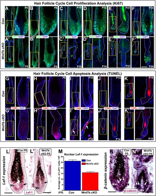 Wnt7b ablation results in a shorter hair cycle with premature catagen onset and delayed anagen entry. (A–F′): Immunofluorescence targeting the cell proliferation marker, Ki67 (green), during the postnatal hair cycle (from P5 to P24) in Con (A–F) and Wnt7b cKO (A′–F′) mice. TUNEL staining (red) was used to detect cell apoptosis and indicates initiation of the degenerative hair follicle phase, catagen, in Con (G–K) and Wnt7b cKO (G′–K′) hair follicles. DAPI (blue) counterstaining was used to label cell nuclei. Arrow marks the TUNEL positive, degenerating epithelial strand. Immunohistochemistry (IHC) detecting nuclear Lef-1 (purple) in Con (L) and Wnt7b cKO (L′) at P5 with quantification of the number of nuclear Lef-1 positive cells per hair follicle (HF) (M). (N, N′): IHC targeting β-catenin expression in P5 Con (N) and Wnt7b cKO (N′) HFs. Scale bar = 50 µm. Abbreviation: DAPI, 4′,6-diamidino-2-phenylindole; Mx, matrix; P, postnatal day; Lef-1, lymphoid enhancer-binding factor 1.