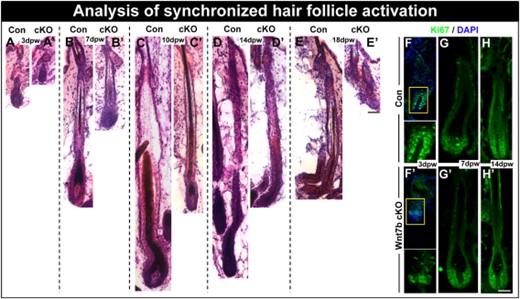 Wnt7b-deficient hair follicles display delayed anagen entry after hair cycle synchronization by depilation. (A–E′): Con and Wnt7b cKO dorsal hair were waxed to synchronize hair follicle activation (promoting anagen entry) and hair regrowth monitored and stained by H&E. (A): After 3 days postwaxing (dpw) Con hair follicles (HFs) revealed HF downgrowth in early anagen with HFs extending into the subcutaneous fat layer; however, at the same time point (A′), Wnt7b cKO HF regrowth appeared delayed and remained more superficial to the epidermis. (B): At 7 d pw, Con anagen HFs extended deep into the subcutaneous fat tissue (B′), whereas Wnt7b cKO still remained delayed by comparison. (C): After 10 d pw, Con full anagen HFs produced thick, pigmented hair shafts; (C′) however, Wnt7b cKO HFs appeared considerably thinner with delayed downgrowth into the dermis. (D): 14 d pw, Con HFs remained in anagen (D′); however, Wnt7b cKO HFs were in early catagen. (E): At 18 d pw, the lower portion of Con HFs was beginning to degenerate in catagen, whereas Wnt7b cKO HFs had already transitioned to telogen (E′). (F–H′): Immunofluorescence detecting Ki67 (green) in regenerating Con (F–H) and Wnt7b cKO (F′–H′) HFs at 3 dpw (F, F′), 7 dpw (G, G′), and 14 dpw (H, H′). DAPI (blue) counterstaining was used to label cell nuclei in immunofluorescence images. Scale bar = 50 µm. Abbreviation: DAPI, 4′,6-diamidino-2-phenylindole.