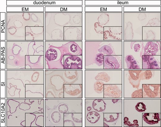Immunohistochemical characterization of human organoids. Organoids were generated from human duodenal and ileal biopsies and maintained in EM for 7 weeks. Differentiation was induced by incubation in DM for 5 days. Organoids were embedded in paraffin, sectioned, and stained for PCNA, AB‐PAS, SI, and SLC10A2 (ASBT). Original magnification ×20, insets ×50. Abbreviations: AB‐PAS, Alcian Blue periodic acid Schiff; DM, differentiation medium; EM, expansion medium; PCNA, proliferating cell nuclear antigen; SI, sucrase‐isomaltase.