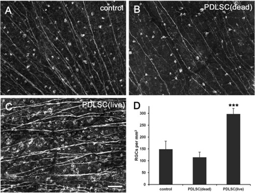 人PDLSCs促进成年大鼠视神经挤压后RGC存活。荧光显微照片显示，在（A）生理盐水对照组、（B）注射死亡PDLSC和（C）注射活PDLSC的ONC后3周，成年大鼠视网膜平板上的βIII-管蛋白阳性存活RGC。（D） ：ONC后3周每平方毫米存活RGC的平均数量。***，p<.001.比例尺：50μm。缩写：PDLSC，牙周韧带源性干细胞；视网膜神经节细胞。