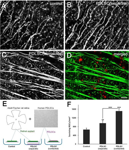 RGC在与人PDLSC共培养的大鼠视网膜移植物中存活。荧光显微照片显示不同条件下视网膜外植体培养物中βIII微管蛋白+存活RGC和神经纤维束的特征。（A） ：仅视网膜；（B） 视网膜与分离的PDLSC共培养；（C，D）相同视野的视网膜（绿色）与放在顶部的PDLSC（红色）共培养。（E） ：分离和接触共培养图。ONC术后3周每平方毫米存活RGC的平均数量如（F）所示。**，p<.01；***，p<.001.比例尺：50μm。缩写：PDLSC，牙周韧带源性干细胞；视网膜神经节细胞。