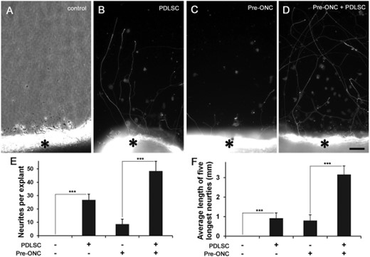 有或无ONC前体的大鼠视网膜移植后神经突起生长。在（A）对照组（无共培养）和（B）PDLSC共培养组中，βIII-管蛋白阳性神经突起从无前ONC的视网膜外植体中生长出来。在（C）对照组（无共培养）和（D）PDLSC共培养组中，βIII-管蛋白阳性神经突起从含有前ONC的视网膜外植体中生长出来。*视网膜外植体边缘。（E） ：突起的平均数目和（F）长度。***，p<.001.比例尺：50μm。缩写：ONC，视神经挤压；PDLSC，牙周韧带源性干细胞。
