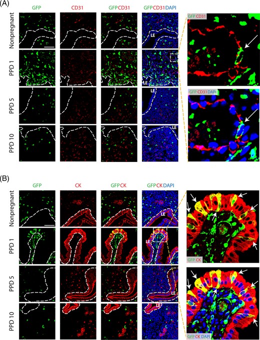 Co-immunolocalization of GFP+ bone marrow-derived cells (BMDCs) with CD31 and cytokeratin markers. A, Immunofluorescence of uterine tissue sections showing colocalization of GFP-positive BMDCs (green), with CD31 endothelial marker (red) across nonpregnant and postpartum day (PPD) 1, 5, and 10. Sections were counterstained with DAPI (blue) for nuclear staining. The dashed white line indicates the border of the luminal epithelium (LE). Images on the right are magnified images of the dashed square area. They show a bone marrow-derived endothelial cell integrated into a blood vessel on postpartum day 1 (white arrow), as visualized with GFP-positive cell colocalized with CD31 staining. B, Immunofluorescence of uterine tissue sections showing colocalization of GFP-positive BMDCs (green) with the epithelial marker cytokeratin (CK) (red) across nonpregnant and postpartum day (PPD) 1, 5, and 10. Sections were counterstained with DAPI (blue) for nuclear staining. The dashed white line indicates the border of the luminal epithelium (LE). Magnified images to the right show GFP+ bone marrow-derived epithelial cells (white arrows) exhibiting typical epithelial morphology and integrated into the luminal epithelium on PPD1. Images were obtained with 40× lens. Scale bar = 50 μm
