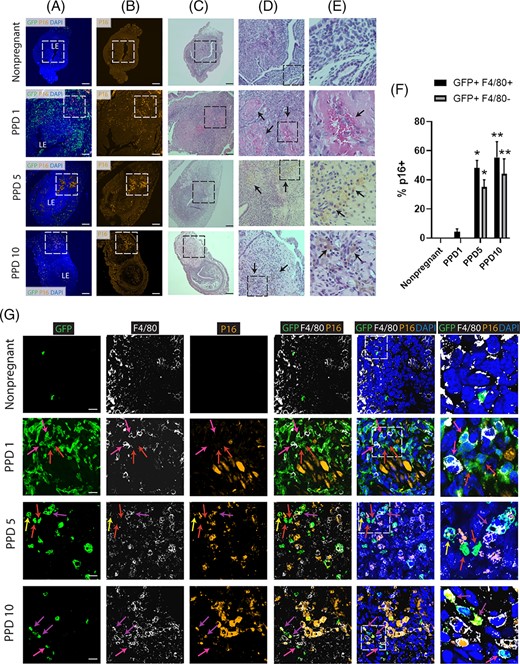 Senescence of bone marrow-derived cells (BMDCs) in the postpartum uterus. A,B, Immunofluorescence of uterine tissue sections showing colocalization of GFP-positive BMDCs (green) and P16-positive senescent cells (orange) across postpartum time points and nonpregnant uterus; sections were counterstained with DAPI for nuclear staining (blue). LE indicates the luminal epithelium. Note the white dashed squares on PPD1, PPD5, and PPD10 that are rich in p16-positive senescent areas within the implantation scar. The white dashed area in (B) is corresponding to the black dashed area in (C). C-E, H&E staining of uterine tissue sections across postpartum time points and nonpregnant uterus. C, 10× magnification showing black dashed square area which corresponds to the white dashed area in (A, B). D,E, Column D are magnified (20×) H&E images of the black square in (C), and column E are magnified (40×) images of the black square area in (D). Black arrows on PPD1 in (D) are pointing to areas of fibrin deposition to the extracellular matrix and hemorrhage from blood vessel in (E). On PPD5 and PPD10, black arrows in (D) are pointing to areas rich in hemosiderin, a red blood cell product, indicating active areas of tissue organization and repair. Higher magnification images in (E) from PPD5 and PPD10 show black arrows pointing to hemosiderin-laden macrophages. Scale bar = 200 μm. F, Quantitative summary of immunostaining from (G) showing percentage of GFP+/F4/80+ cells and GFP+/F4/80− cells that express p16 senescence marker across postpartum time points and nonpregnant state. n = 3 in all groups. *P < .05 and **P < .01 vs nonpregnant and PPD1 time points. G, Immunofluorescence of uterine tissue sections from nonpregnant and across postpartum time points showing colocalization of GFP-positive BMDCs (green), F4/80 macrophage marker (white), and p16-positive senescent cells (orange). Sections were counterstained with DAPI for nuclear staining (blue). Red arrows point to nonhematopoietic GFP+ BMDCs that are negative for p16. Pink arrows point to GFP+/F4/80+ BM-derived macrophages that are p16-negative. Yellow arrows point to nonhematopoietic GFP+/P16+ senescent cells. Purple arrows point to GFP+/F4/80+/P16+ BM-derived senescent macrophages. Dashed white squares in merged images show tissue area that is magnified in the column to the right. Note the near absence of senescent (p16+) BMDCs on PPD1, and gradual appearance of p16+ BMDCs on PPD5 and PPD10. Scale bar = 20 μm