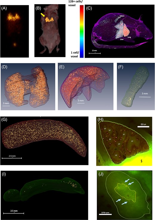 Biodistribution of multipotent adult progenitor cells (MAPCs) and murine T-cells (mTCs) within allogeneic and syngeneic transplant-recipient spleens. Irradiated B6D2F1 mice received syngeneic or allogeneic blood and marrow transplantation (BMT) as described in Figure 1, and subsets of allogeneic mice received MAPC infusions on D1. Using cryo-imaging, red Qdot-labeled MAPCs (rendered in gold) and SPECT scanning, the biodistribution of MAPCs was analyzed at 1, 6, 24, and 48 hours following tail vein injection as described in Section 2. A,B, As anticipated, the majority of labeled cells are found in lung (yellow arrow) 1 hour after intravenous infusion. C-F, By 24 hours postinjection, cells can be seen redistributing from the lung and to the liver, and spleen of allogeneic BMT recipient mice as captured by three-dimensional, computer-generated imagery. G,I, Examination of cryo-microscopic imaging under low power confirms accumulation in the spleen and lymph nodes and high-power view, H,J, demonstrates MAPCs specifically localizing in the splenic marginal zone and the paracortex of the mesenteric lymph nodes. K, kidney; S, stomach; RP, red pulp; WP, white pulp