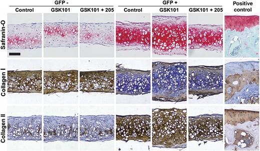 Tissue accumulation, Safranin-O staining, and collagen types I and II immunohistochemistry (IHC) in induced pluripotent stem cell (iPSC)-derived chondroprogenitors after transient activation of TRPV4. Increases in tissue thickness and Safranin-O labeling were observed in GSK101-treated GFP+ cells at day 21, and this effect was inhibited by the TRPV4 antagonist, GSK205. IHC revealed increased collagen type II staining in GFP+ micromasses, while GFP− micromasses displayed increased collagen type I staining. Positive controls were performed on the mouse tibial plateau. Scale bar = 100 μm