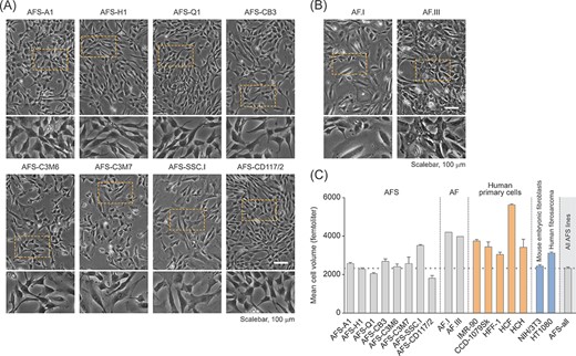 Human amniotic fluid stem cell (hAFSC) characterization for cell morphology and cell size. A,B, Phase contrast imaging for the evaluation of cell morphology in c-Kit-selected hAFSC lines (A) and low passage human amniotic fluid cells obtained via amniocentesis performed for routine prenatal diagnosis (B). The bottom panels represent a twofold magnification of the corresponding image section marked with a rectangle. C, Volume-based cell size distribution of logarithmically growing hAFSCs (AFS). For comparison, human amniotic fluid cells (AF) and primary as well as immortalized/transformed cells of mesenchymal origin were co-analysed. The latter include fetal/neonatal primary human lung and foreskin fibroblasts (IMR-90 and CCD-1079Sk, HFF-1, respectively), adult primary cardiac fibroblasts and chondrocytes (HCF and HCH, respectively), mouse embryonic fibroblasts (NIH/3T3) and human fibrosarcoma cells (HT1080). “AFS-all” represents the average of all values obtained for the hAFSC lines shown