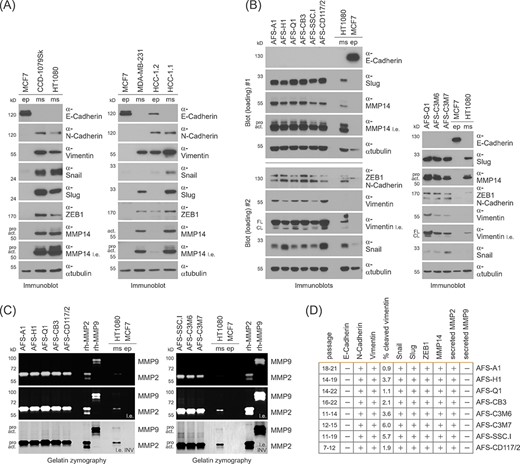 The epithelial-mesenchymal transition (EMT)-related marker profile of human amniotic fluid stem cells (hAFSCs). A, Immunoblotting for the detection of EMT-related marker proteins in epithelial (ep) and mesenchymal (ms) cells of fibroblast (CCD-1079Sk, HT1080), mammary (MCF7, MDA-MB-231), and hepatic (HCC-1.2, HCC-1.1) origins. l.e., long exposure; pro, pro-form; act, active form. B, Immunoblotting for the analysis of EMT-related marker proteins in hAFSCs. Epithelial and mesenchymal cells were co-analysed as a reference. For data presented in the left panel, the same lysates were separated on two different gels (Blot#1 and Blot#2). l.e., long exposure; pro, pro-form; act, active form; FL, full-length; CL, cleaved. C, Gelatin zymography for the detection of secreted MMPs in hAFSCs. Recombinant human MMP2 and MMP9, and cells of epithelial and mesenchymal origin were co-analyzed as controls. For better visualization of results, a color-inverted version of the long exposure was included (l.e. INV). D, Summary of results obtained in B and C including the hAFSC passage numbers and the quantification results for inactive, cleaved vimentin