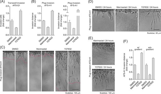 Inhibition of Rho-associated kinase triggers an increase in human amniotic fluid stem cell (hAFSC) invasion and a shift toward a fully mesenchymal phenotype. A, Transwell invasion assay of AFS-Q1 treated with the broad spectrum MMP-inhibitor Marimastat (10 μM) or the ROCK inhibitor Y27632 (10 μM) at 22 hours of incubation. B, Plug invasion assays of AFS-H1 and AFS-A1 at 72 hours of incubation upon inhibition of matrix metalloproteases (MMPs) or Rho-associated protein kinase (ROCK) as described in A. C, Pictures of AFS-A1 invading the reconstituted basement membrane (rBM) plug representative of data in B. Two sections per condition of the same experiment are shown. The area between the two dotted lines marks the invasion area used for quantification of the invasion distance. D,E, Close-up view of Marimastat- or Y27632-treated AFS-A1 (D) and AFS-H1 (E) invading the rBM plug at 24 hours of incubation for the visualization of early effects of inhibitor treatments. (F) Plug invasion assay of 24 hours Marimastat- or Y27632-treated AFS-Q1 upon modification of the growth factor gradient. The w/gradient condition represents the standard condition used in this study