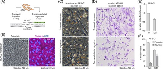 Human amniotic fluid stem cell (hAFSCs) harbor transendothelial migration potential. A, Illustration of the transendothelial migration (TEM) assay. The TEM assay is based on a transwell invasion (TWI) assay set-up (Figure 3) in which the rBM layer is seeded with primary human umbilical vein endothelial cells (HUVEC) to mimic the inner surface of a vessel wall composed of the endothelium sitting on top of a basement membrane. B, Representative brightfield and immunofluorescence images of HUVEC seeded into a transwell (left panel) or stained for F-actin (right panel) to monitor the formation of a compact cell monolayer. For better visualization of staining results, phalloidin labeling for the detection of F-actin was performed in a matched control well. C,D, TWI and TEM assays of AFS-Q1 at 22 hours of incubation. Pictures show non-invaded cells on top of the rBM (TWI) or on top of the HUVEC monolayer (TEM) (C) and invaded cells on the transwell bottom membrane after crystal violet-staining (D). Yellow arrows, hAFSCs (AFS); white arrows, HUVEC (HU); p, pore. E, Quantification of TEM results (number of invaded cells) in relation to TWI results. F, Relative contribution of elongated and rounded cells among invaded cells upon TWI and TEM