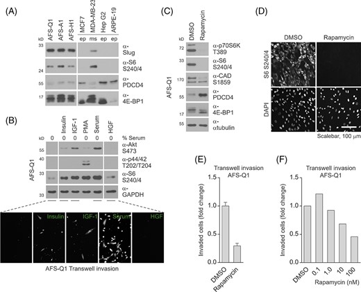Human amniotic fluid stem cell (hAFSC) invasion is mediated by mTORC1. A, Immunoblotting for the detection of mTORC1 downstream targets S6, PDCD4, and 4E-BP1 in hAFSCs. For comparison, epithelial (ep) and mesenchymal (ms) cells of different origin and the epithelial-mesenchymal transition (EMT)-related transcription factor Slug were co-analyzed. B, Immunoblotting (upper panel) and transwell invasion assay (lower panel) of AFS-Q1 upon stimulation with insulin, insulin-like growth factor (IGF-1), and serum for the evaluation of mTORC1 pathway activation via Akt and S6 and cellular invasion, respectively. PMA and hepatocyte growth factor (HGF) treatments and the detection of p44/42 phosphorylation were co-evaluated as positive and negative controls. C,D, Immunoblotting (C) and immunofluorescence (D) of mTORC1 downstream targets in Rapamycin-treated AFS-Q1 as indicated for verification of mTORC1 pathway inhibition at the population and single-cell level, respectively. E,F, Transwell invasion assays of AFS-Q1 upon Rapamycin treatment as indicated at 22 hours of incubation. For data presented in C-E, Rapamycin was used at a standard concentration of 100 nM