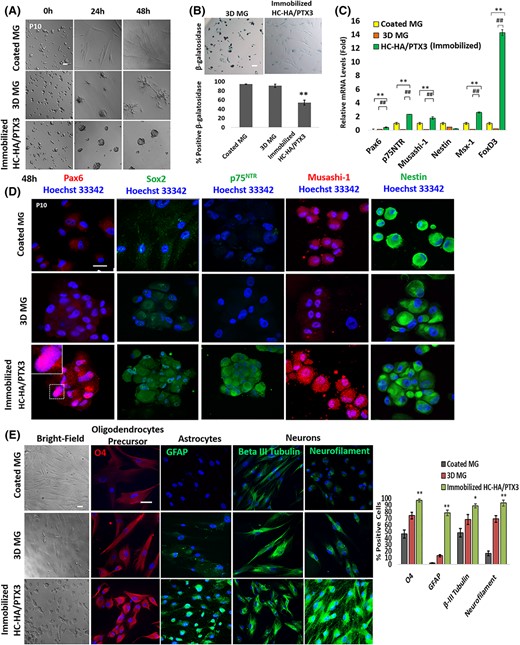 Immobilized HC-HA/PTX3, but not on 3D MG, reverts P10 LNC to nuclear Pax6+ neural crest progenitors